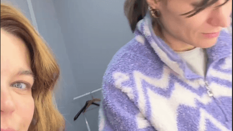 Ирина Пегова напугала фанатов разбитой губой