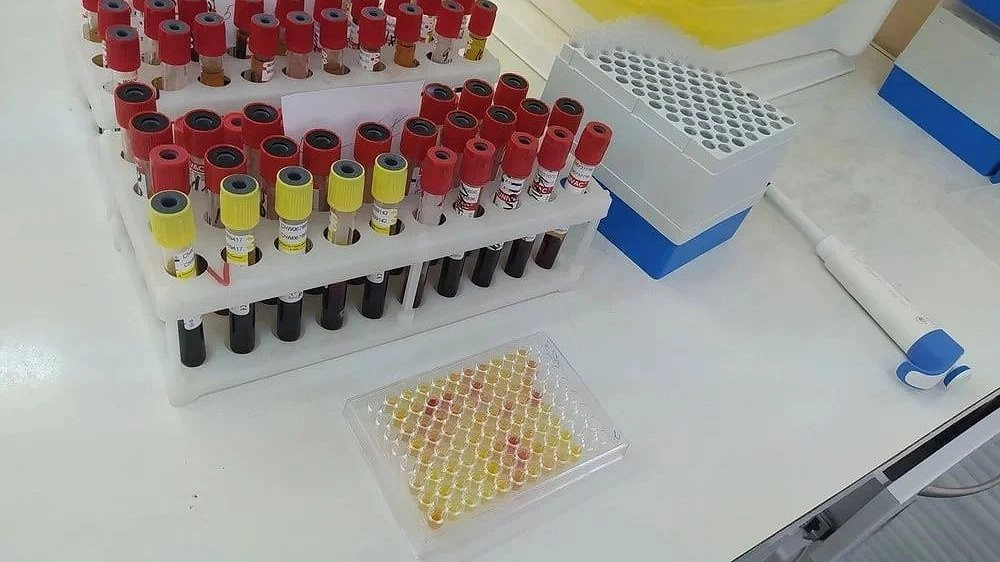 15 детей заразились ВИЧ в Нижегородской области