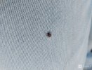 36 нижегородцев обратились в медучреждения из-за присасывания клещей