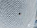 Более 2 тысяч нижегородцев обратились в медучреждения из-за клеще