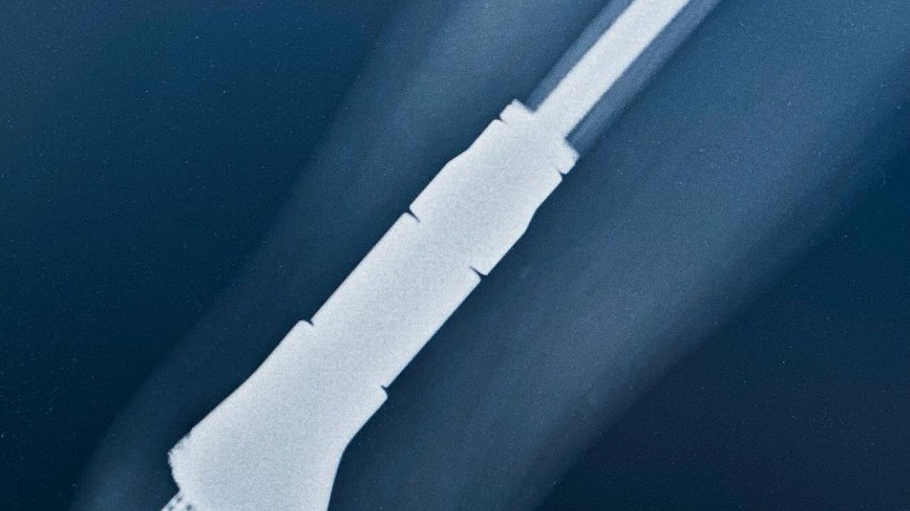 Главная картинка новости: Ребенка с агрессивным видом рака спасли в Нижнем Новгороде